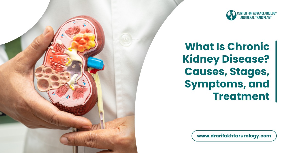What Is Chronic Kidney Disease? Causes, Stages, Symptoms, and Treatment