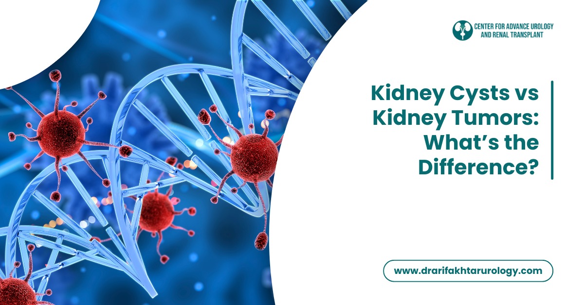 Kidney Cysts vs Kidney Tumors: What’s the Difference?