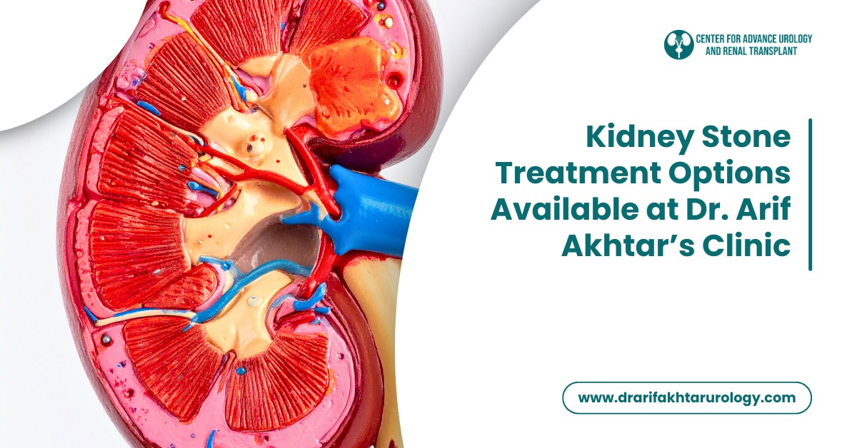 Kidney Stone Treatment Options Available at Dr. Arif Akhtar’s Clinic