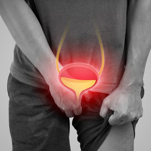 Prostate Cancer Screening & Treatment in Gurgaon