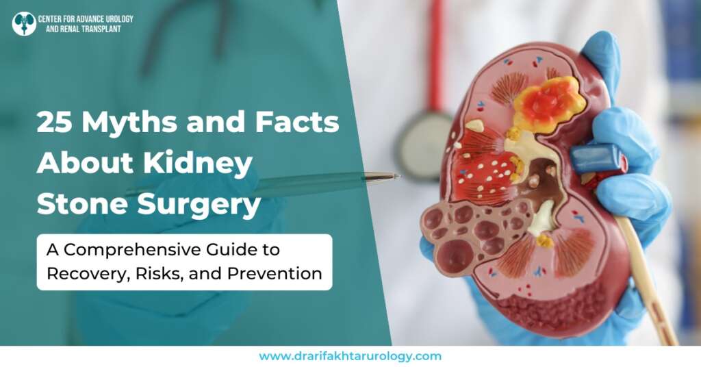 25 Myths and Facts About Kidney Stone