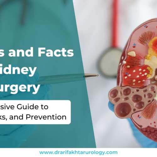 25 Myths and Facts About Kidney Stone