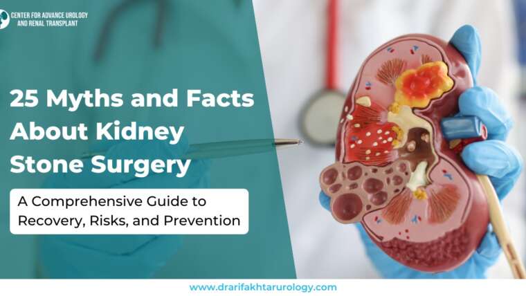 25 Myths and Facts About Kidney Stone