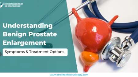 Benign Prostate Enlargement Symptoms & Treatment