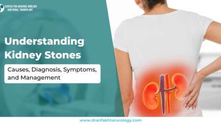 Understanding Kidney Stones