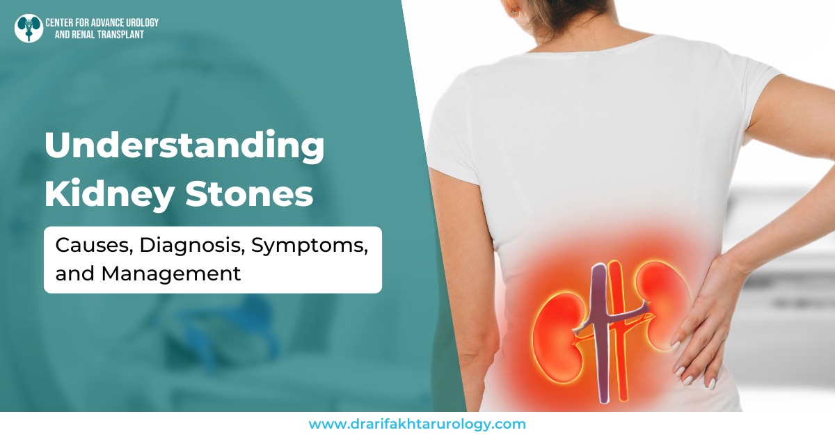 Understanding Kidney Stones