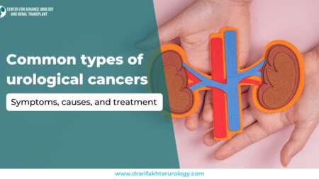 Common Types of Urological Cancers Symptoms, Causes, and Treatment