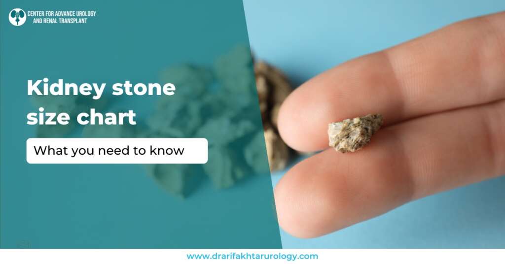 Kidney Stone Size Chart What You Need to Know