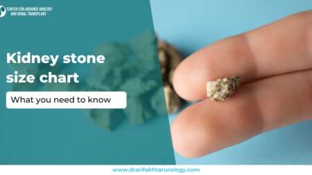 Kidney Stone Size Chart What You Need to Know