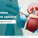 Kidney Stone Treatment Options: Which One is Right for You?