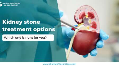 Kidney Stone Treatment Options Which One is Right for You