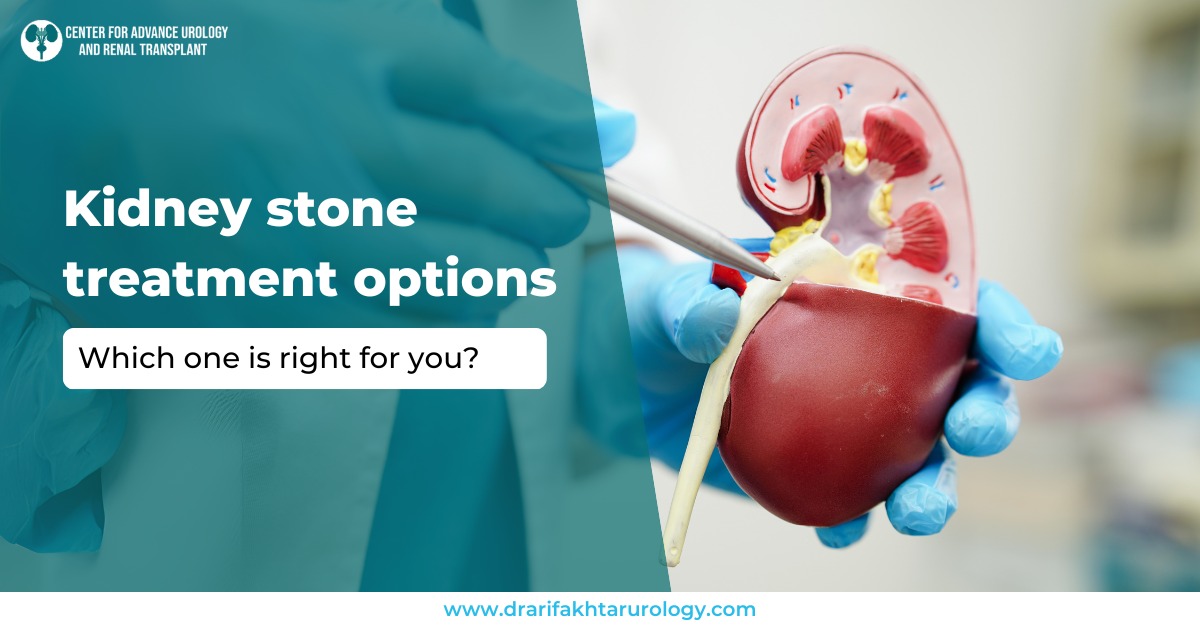 Kidney Stone Treatment Options Which One is Right for You