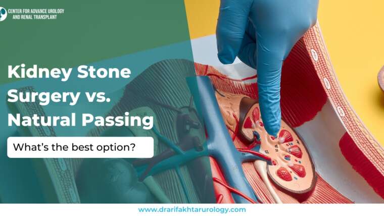Kidney Stone Surgery vs. Natural Passing What’s the Best Option
