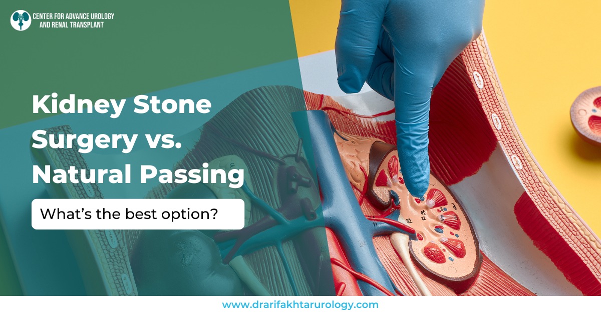 Kidney Stone Surgery vs. Natural Passing What’s the Best Option