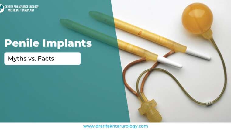 Penile Implants Myths vs Facts