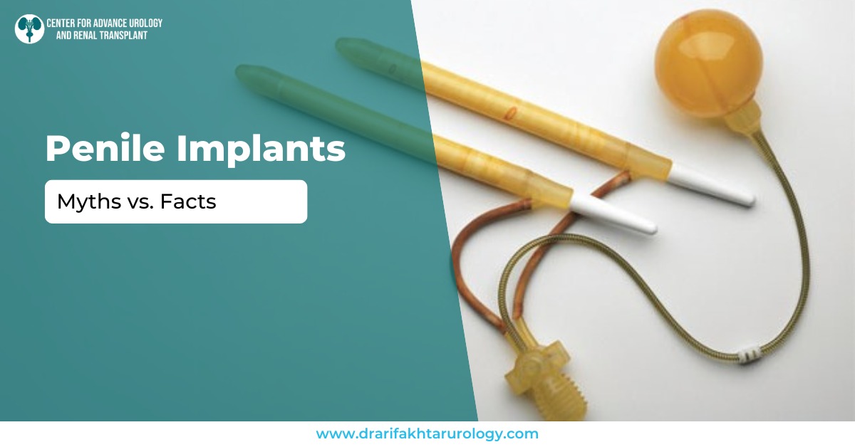 Penile Implants Myths vs Facts