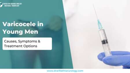 Varicocele in Young Men Causes, Symptoms & Treatment Options