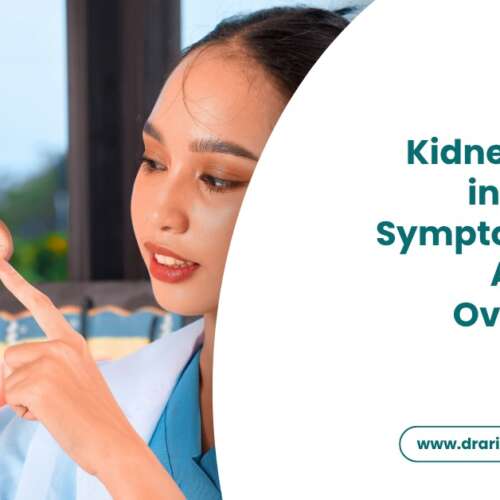 Kidney Stones in Women Symptoms That Are Often Overlooked