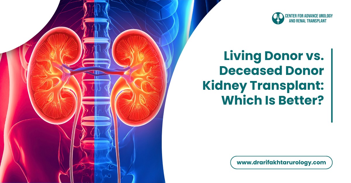 Living Donor vs. Deceased Donor Kidney Transplant – Which Is Better