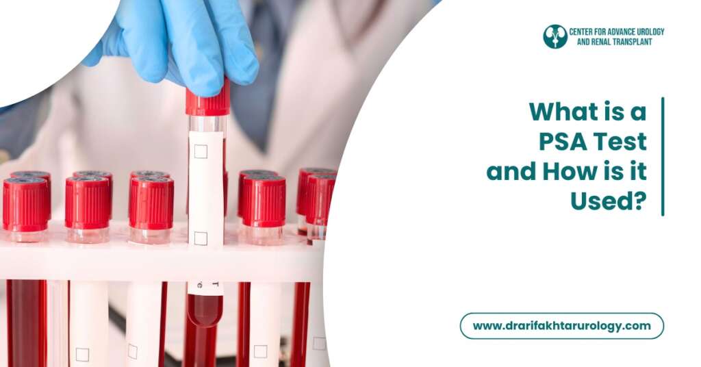 What is a PSA Test and How is It Used?