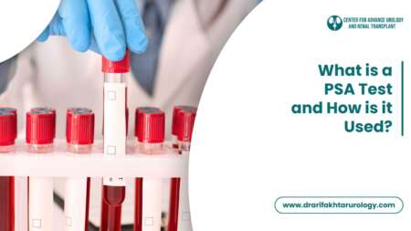 What is a PSA Test and How is It Used?