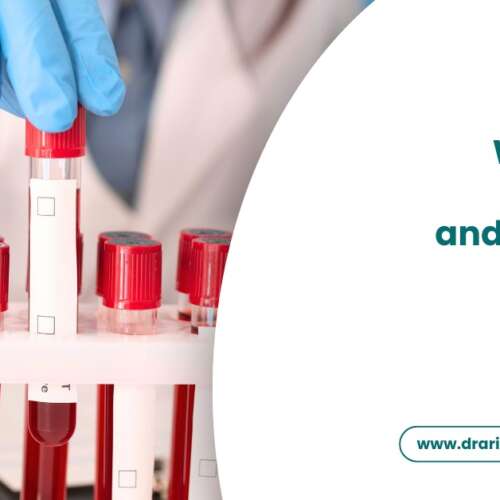 What is a PSA Test and How is It Used?