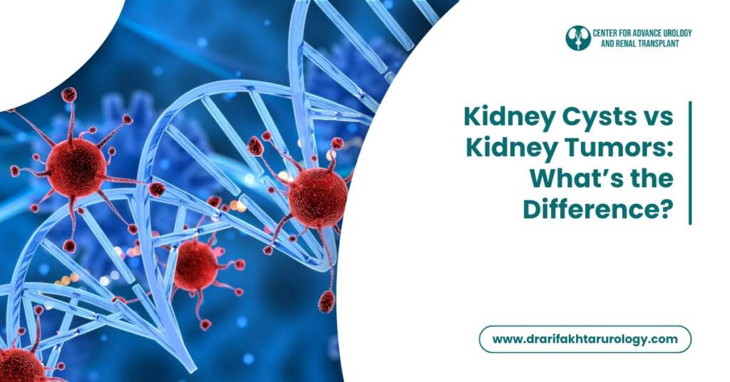 Kidney Cysts vs Kidney Tumors What’s the Difference