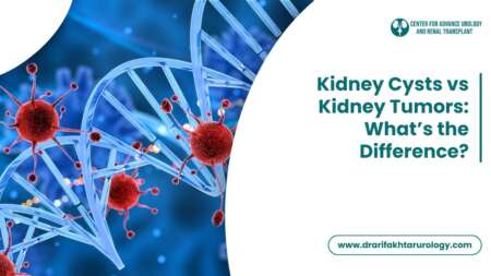 Kidney Cysts vs Kidney Tumors What’s the Difference