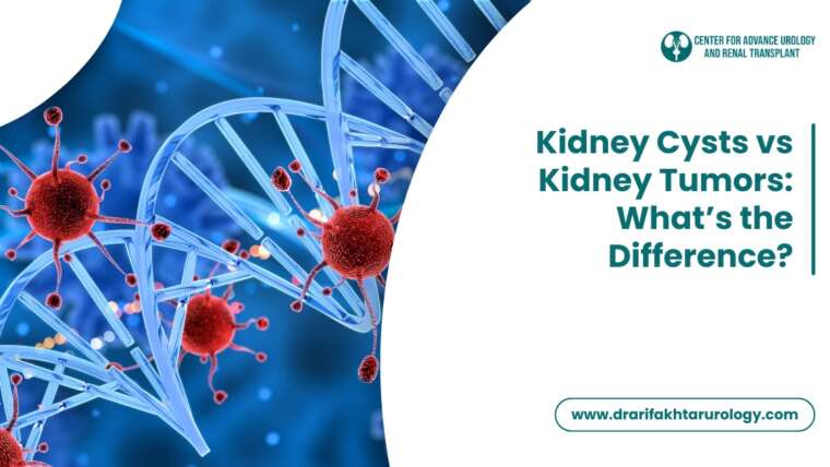 Kidney Cysts vs Kidney Tumors What’s the Difference