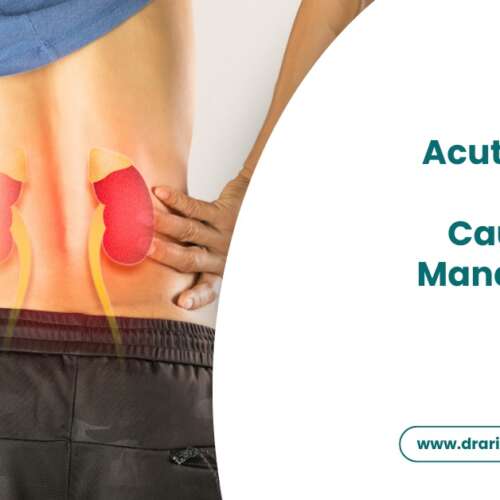 Acute Kidney Injury: Causes and Management