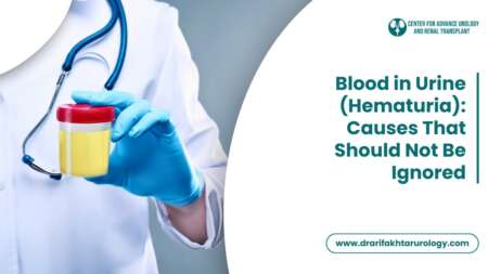 Blood in Urine (Hematuria) Causes That Should Not Be Ignored