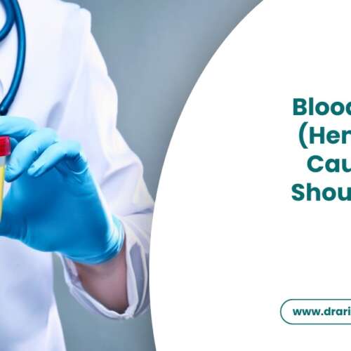 Blood in Urine (Hematuria) Causes That Should Not Be Ignored