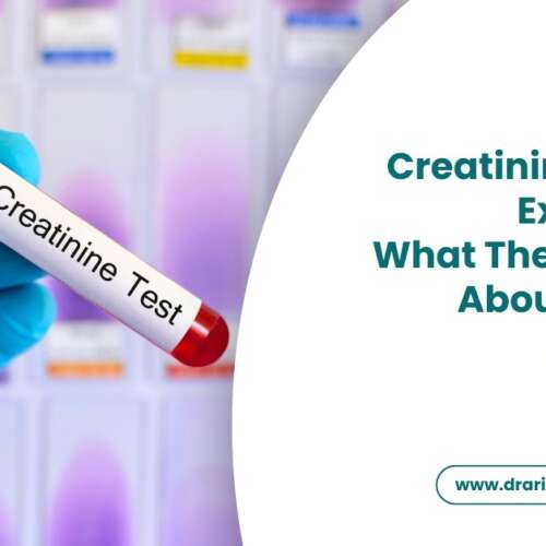 Creatinine Levels Explained What They Reveal About Kidney Function