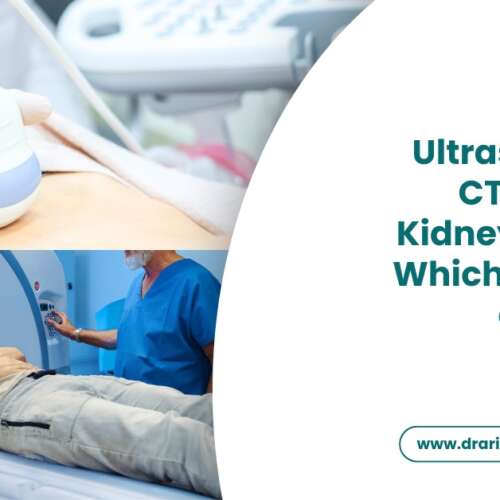 Ultrasound vs CT Scan for Kidney Stones Which Is Better and Why