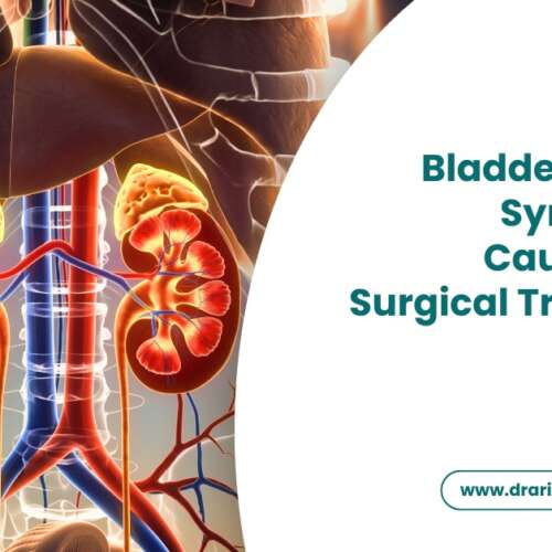 Bladder Stones Symptoms, Causes, and Surgical Treatment