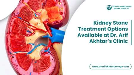 Kidney Stone Treatment Options Available at Dr. Arif Akhtar’s Clinic