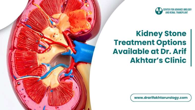 Kidney Stone Treatment Options Available at Dr. Arif Akhtar’s Clinic