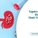 Types of Kidney Stones and Their Treatment Options