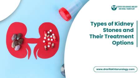 Types of Kidney Stones and Their Treatment Options