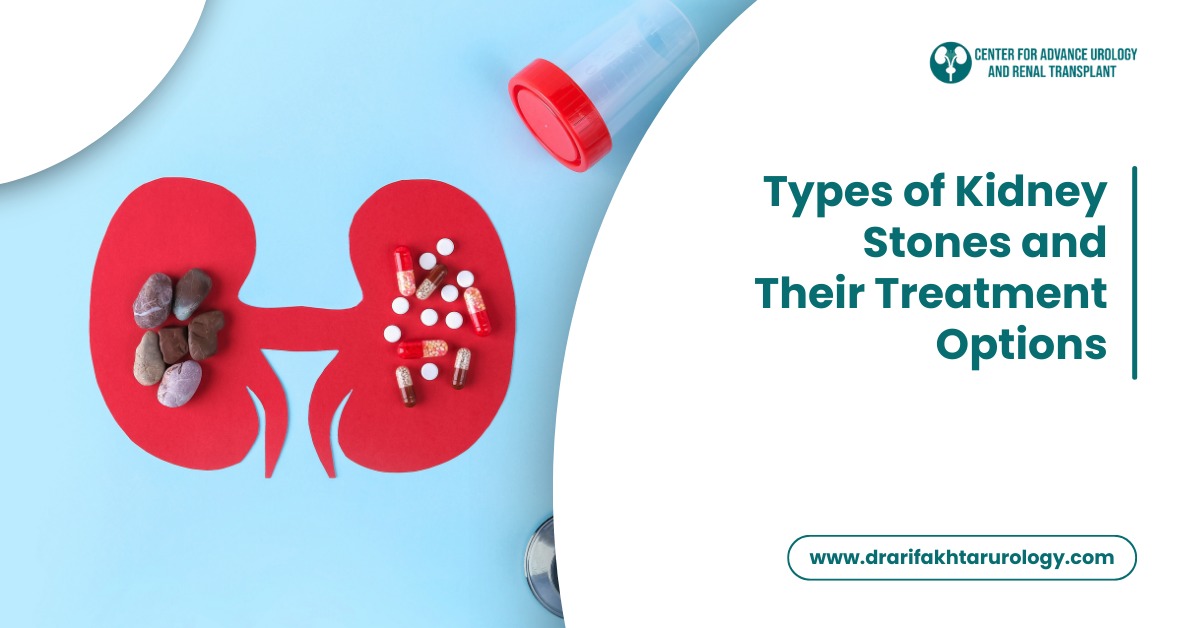 Types of Kidney Stones and Their Treatment Options