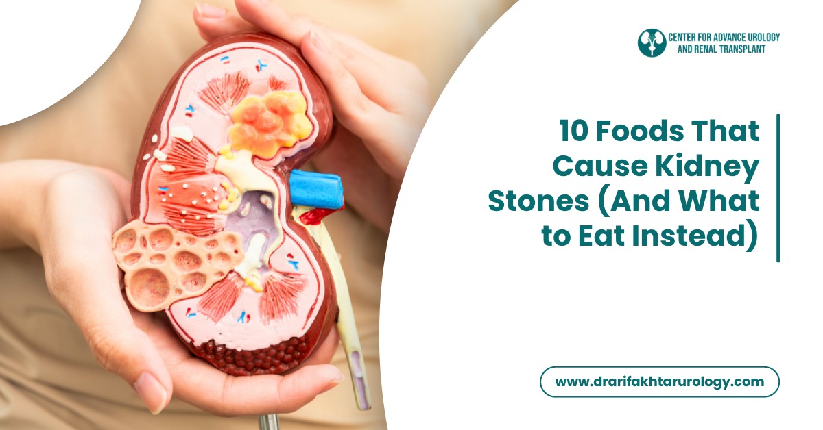 10 Foods That Cause Kidney Stones (And What to Eat Instead)