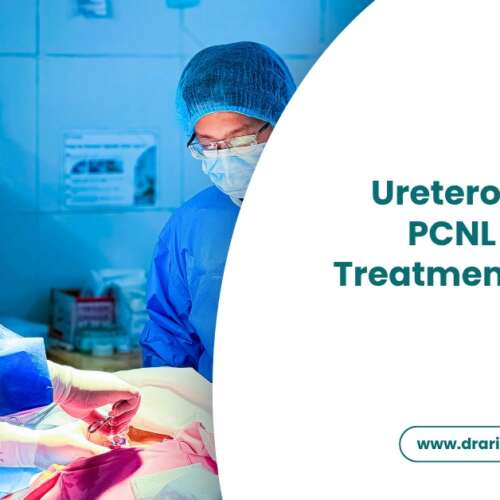 ESWL vs Ureteroscopy vs PCNL — Which Kidney Stone Treatment Is Right for You