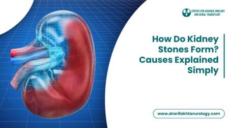 How Do Kidney Stones Form Causes Explained Simply