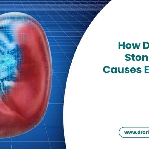 How Do Kidney Stones Form Causes Explained Simply