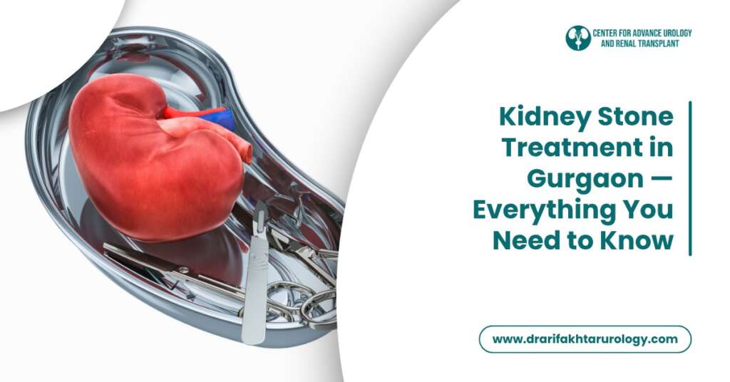 Kidney Stone Treatment in Gurgaon — Everything You Need to Know