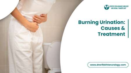 Burning Urination Causes, Diagnosis and Treatment