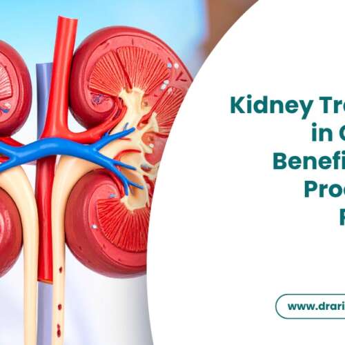 Kidney Transplant in Gurgaon Benefits, Risks, Procedure and Recovery