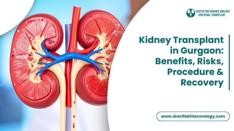 Kidney Transplant in Gurgaon Benefits, Risks, Procedure and Recovery