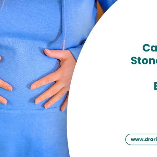 Can Kidney Stones Cause Gas and Bloating?