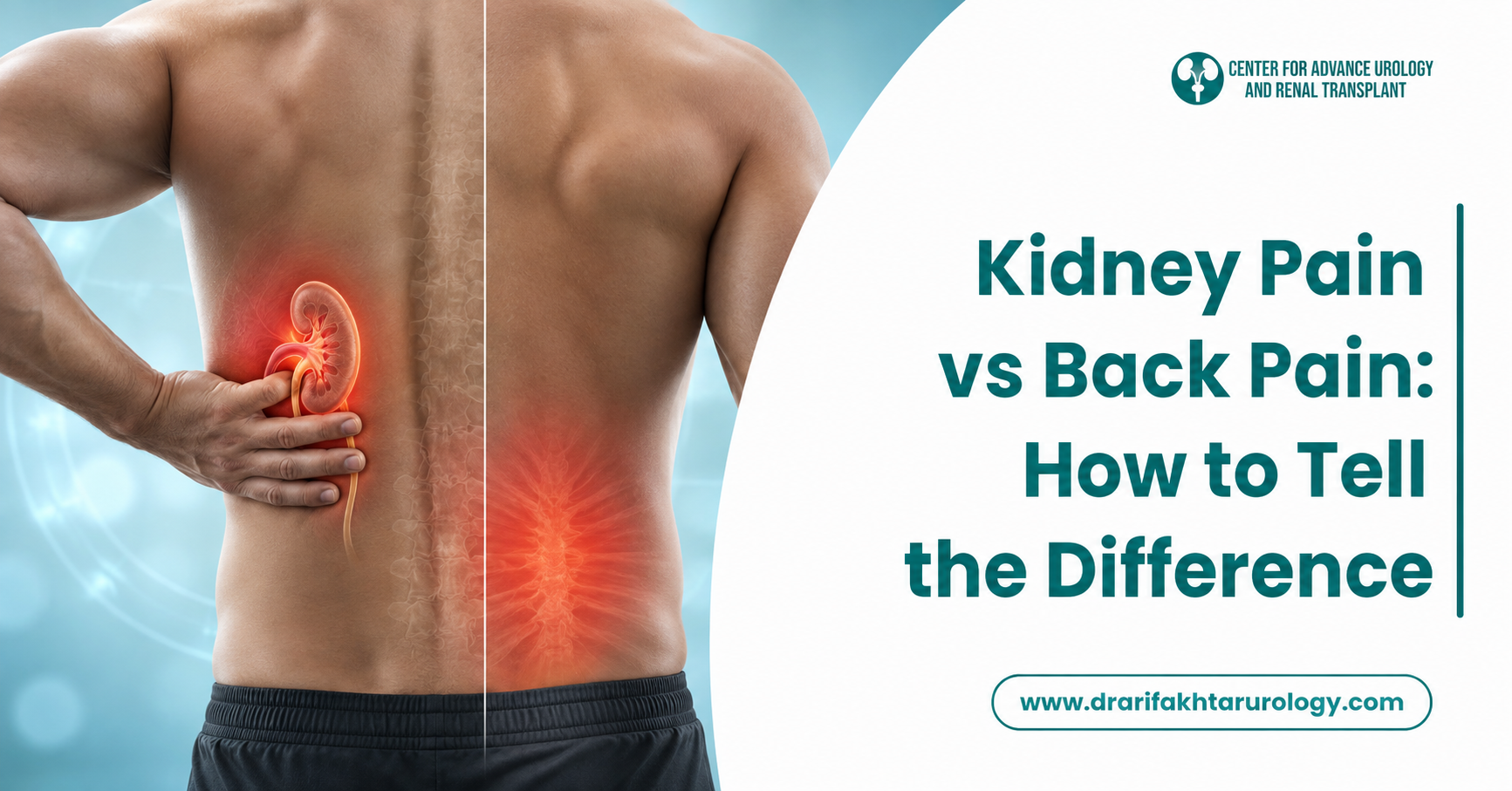 Kidney Pain vs Back Pain How to Tell the Difference